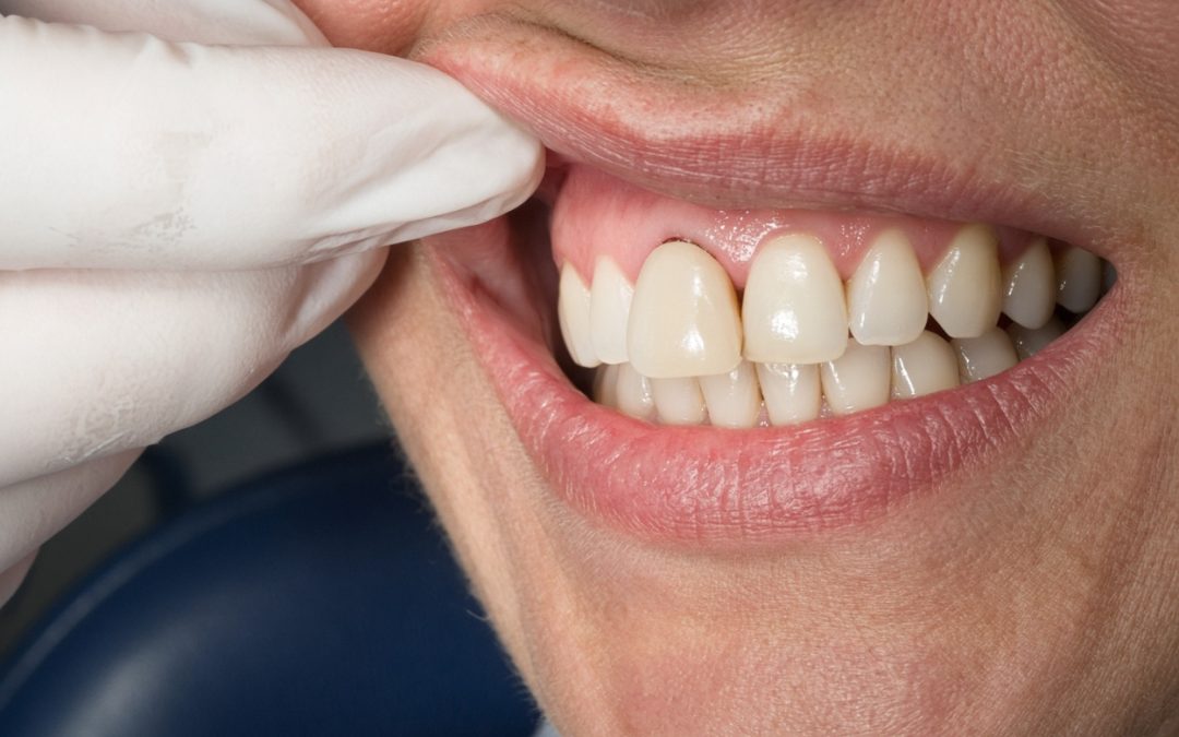 Dunedin Florida Emergency Dentist